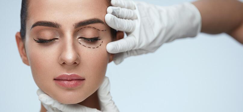 Blepharoplasty
