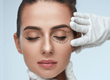 Blepharoplasty
