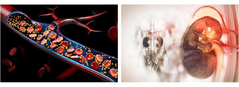 What is Hyperparathyroidism?