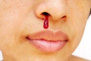 Recognize the danger