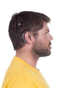 How cochlear implants can help you hear