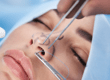 Septoplasty