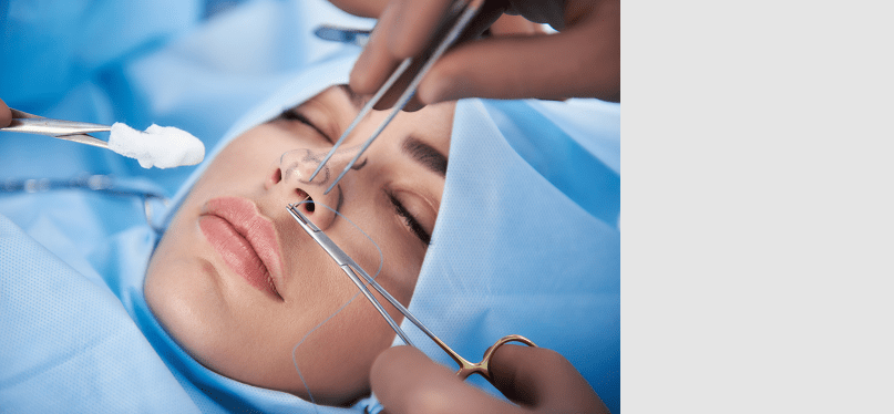 Rhinoplasty (Nose Surgery)